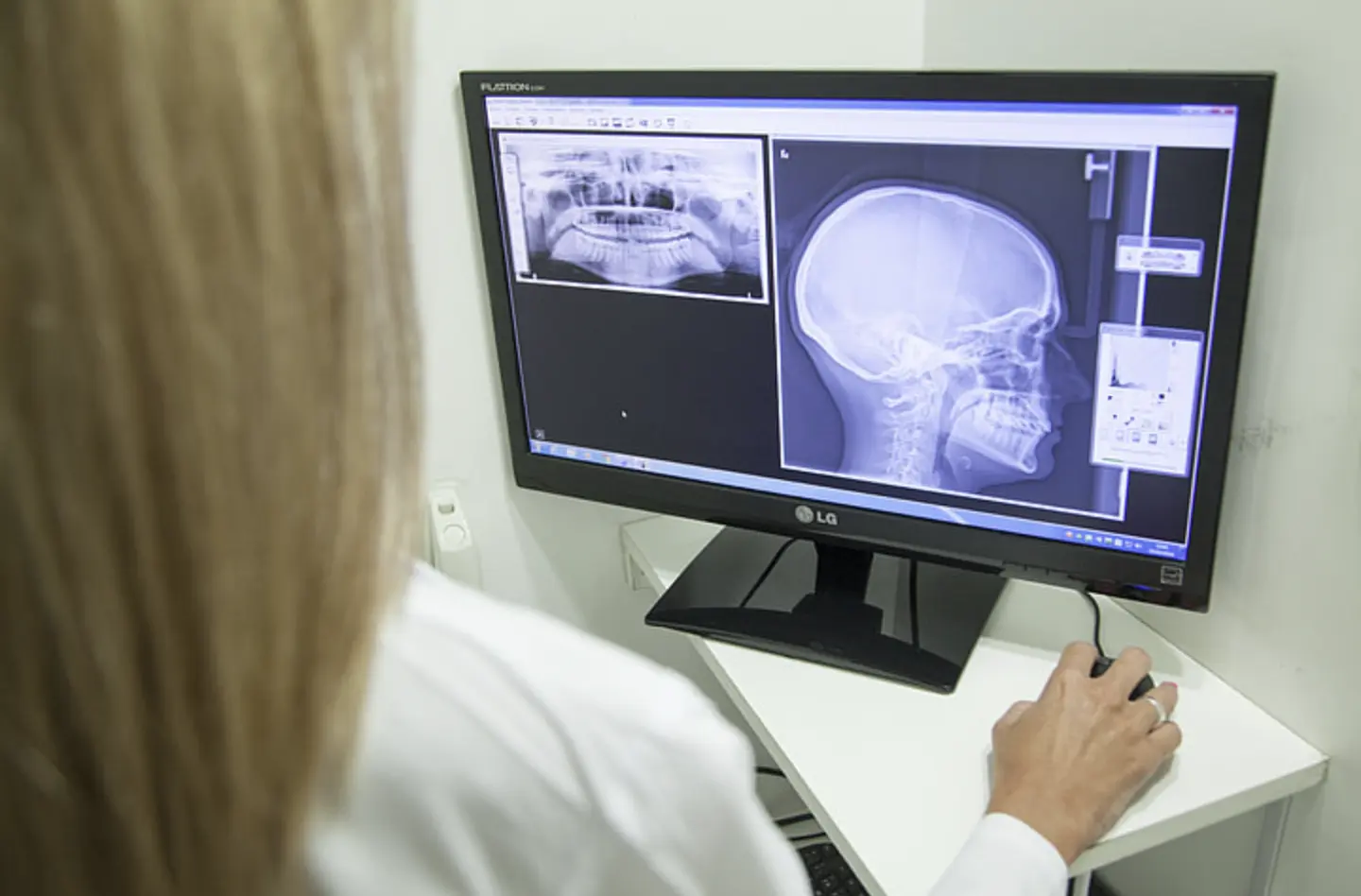 Narzędzie AI Przyspiesza Analizę Obraz&oacute;w Medycznych